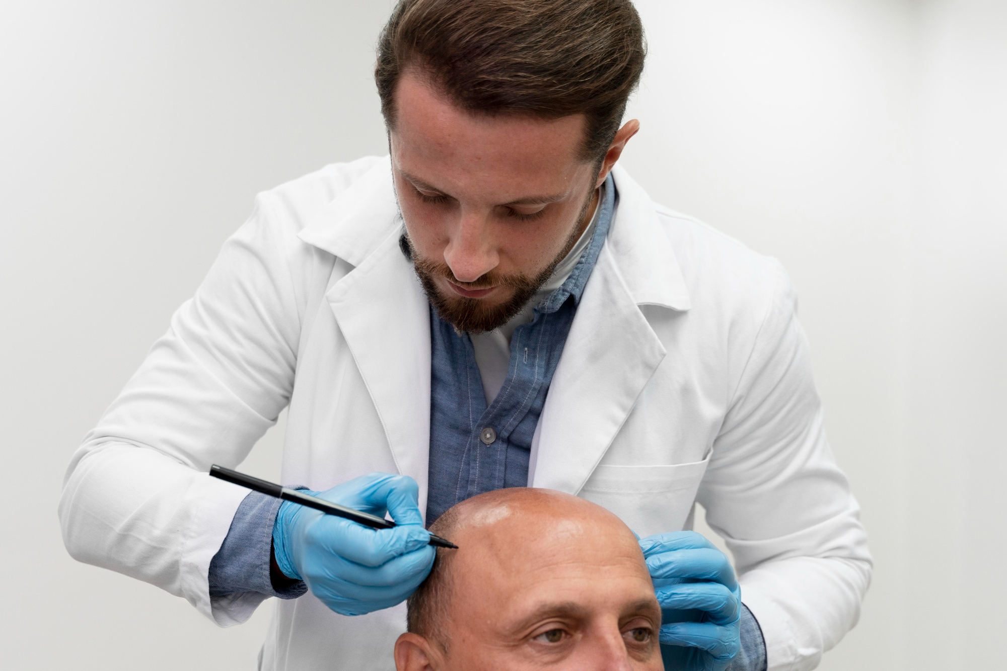 Afro Hair Transplantation